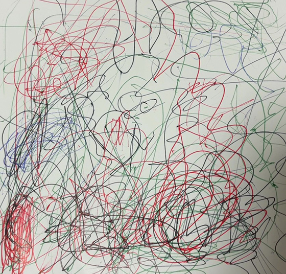 エース